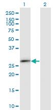 Anti-IGKC Mouse Monoclonal Antibody [clone: 1F6]