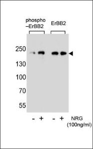 Anti-ERBB2 Rabbit Polyclonal Antibody (HRP (Horseradish Peroxidase))