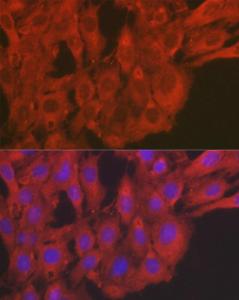 Immunofluorescence analysis of C6 cells using Anti-SOD2/MnSOD Antibody (A306407) at a dilution of 1:50 (40x lens) DAPI was used to stain the cell nuclei (blue)