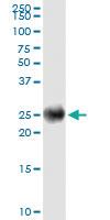 Anti-IGKC Mouse Monoclonal Antibody [clone: 1F6]