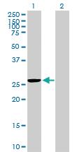 Anti-MRPS35 Mouse Polyclonal Antibody