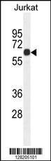 Anti-CCDC8 Rabbit Polyclonal Antibody (Biotin)