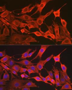 Immunofluorescence analysis of NIH/3T3 cells using Anti-SOD2/MnSOD Antibody (A306407) at a dilution of 1:50 (40x lens) DAPI was used to stain the cell nuclei (blue)