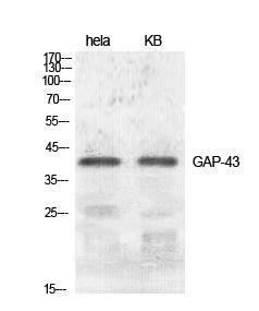 Western blot analysis of various cells using Anti-GAP43 Antibody