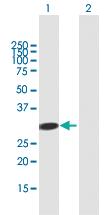 Anti-ADAL Mouse Polyclonal Antibody