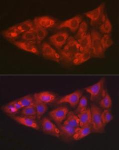 Immunofluorescence analysis of U2OS cells using Anti-SOD2/MnSOD Antibody (A306407) at a dilution of 1:50 (40x lens) DAPI was used to stain the cell nuclei (blue)