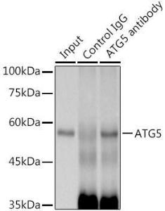 Anti-APG5L/ATG5 Rabbit Monoclonal Antibody [clone: ARC0156]