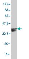 Anti-HEYL Mouse Monoclonal Antibody [clone: 4A11]