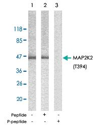 Anti-MAP2K2 Rabbit Polyclonal Antibody