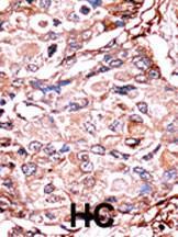 Anti-SMAD3 Rabbit Polyclonal Antibody (APC (Allophycocyanin))