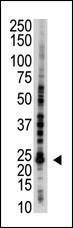 Anti-E2EPF Rabbit Polyclonal Antibody (PE (Phycoerythrin))