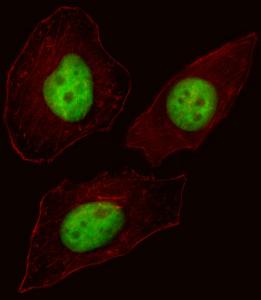 Anti-FOXN3 Rabbit Polyclonal Antibody (AP (Alkaline Phosphatase))