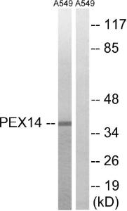 Western blot analysis of lysates from A549 cells using Anti-PEX14 Antibody. The right hand lane represents a negative control, where the Antibody is blocked by the immunising peptide