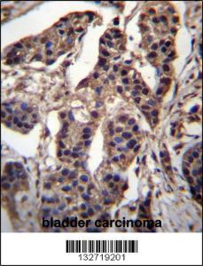 Anti-CG025 Rabbit Polyclonal Antibody (Biotin)