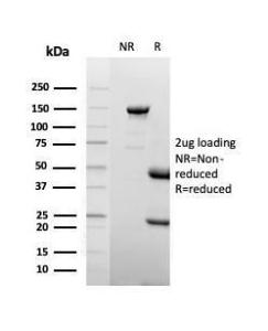 SDS-PAGE analysis of Anti-Lactoferrin Antibody [LTF/4075] under non-reduced and reduced conditions; showing intact IgG and intact heavy and light chains, respectively. SDS-PAGE analysis confirms the integrity and purity of the Antibody