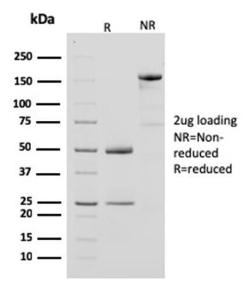 SDS-PAGE analysis of Anti-Creatine Kinase BB Antibody [CPTC-CKB-2] under non-reduced and reduced conditions; showing intact IgG and intact heavy and light chains, respectively. SDS-PAGE analysis confirms the integrity and purity of the antibody