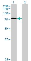 Anti-SSX2 Mouse Polyclonal Antibody