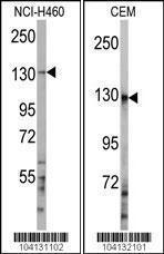 Anti-UBE4A Rabbit Polyclonal Antibody (APC (Allophycocyanin))