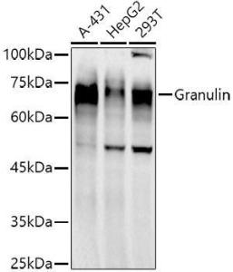 Western blot analysis of extracts of various cell lines, using Anti-Granulin Antibody [ARC51129] (A305510) at 1:1,000 dilution