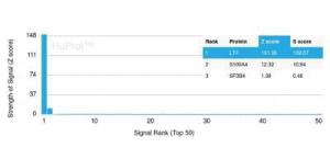 Analysis of protein array containing more than 19000 full-length human proteins using Anti-Lactoferrin Antibody [LTF/4075].