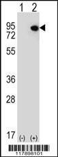 Anti-ELF4 Rabbit Polyclonal Antibody (APC (Allophycocyanin))