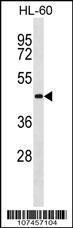 Anti-ATG3 Rabbit Polyclonal Antibody