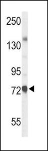 Anti-CHAT Rabbit Polyclonal Antibody