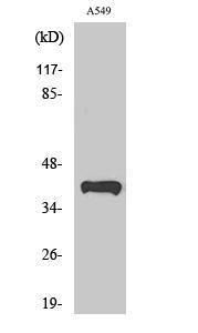 Western blot analysis of various cells using Anti-PEX14 Antibody