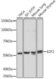 Western blot analysis of extracts of various cell lines, using Anti-E2F2 Antibody [ARC1940] (A305511) at 1:1,000 dilution. The secondary antibody was Goat Anti-Rabbit IgG H&L Antibody (HRP) at 1:10,000 dilution.