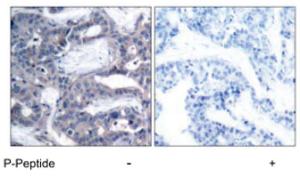 Anti-MAP2K2 Rabbit Polyclonal Antibody