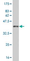 Anti-ARHGAP6 Mouse Monoclonal Antibody [clone: 1G5]