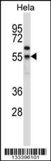 Anti-FOXN4 Rabbit Polyclonal Antibody (APC (Allophycocyanin))