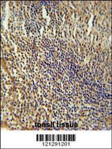 Anti-MEF2A Rabbit Polyclonal Antibody (AP (Alkaline Phosphatase))