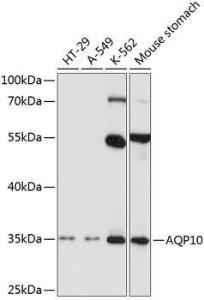 Anti-AQP-10 antibody