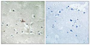 Immunohistochemical analysis of paraffin-embedded human brain using Anti-Trk B (phospho Tyr706+Tyr707) Antibody. The right hand panel represents a negative control, where the antibody was pre-incubated with the immunising peptide.