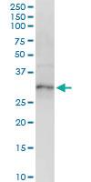 Anti-XBP1 Polyclonal Antibody Pair