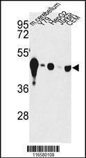 Anti-NSE Rabbit Polyclonal Antibody (AP (Alkaline Phosphatase))