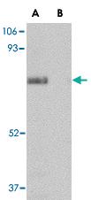 Anti-SCARB2 Rabbit Polyclonal Antibody