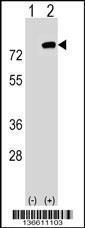 Anti-PBXIP1 Rabbit Polyclonal Antibody (AP (Alkaline Phosphatase))