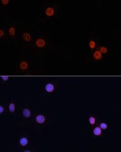 Antibody anti-DNMT3B 100 µl