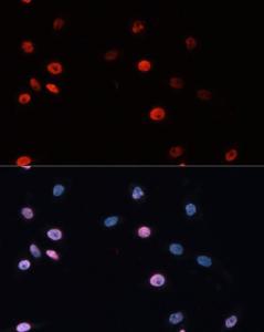 Antibody anti-DNMT3B 100 µl