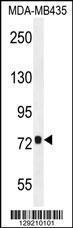 Anti-CCDC81 Rabbit Polyclonal Antibody (FITC (Fluorescein Isothiocyanate))