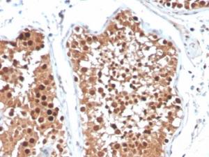 Anti-Inhibin alpha antibody