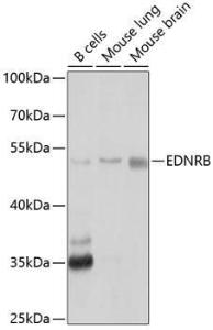 Western blot analysis of extracts of various cell lines, using Anti-Endothelin B Receptor/ET-B Antibody (A11582) at 1:1,000 dilution The secondary antibody was Goat Anti-Rabbit IgG H&L Antibody (HRP) at 1:10,000 dilution Lysates/proteins were present at 25 µg per lane