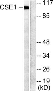 Anti-Cellular Apoptosis Susceptibility Rabbit Polyclonal Antibody