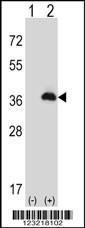 Anti-PEX16 Rabbit Polyclonal Antibody (FITC (Fluorescein Isothiocyanate))