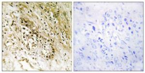 Immunohistochemical analysis of paraffin-embedded human heart tissue using Anti-PDZD2 Antibody. The right hand panel represents a negative control, where the antibody was pre-incubated with the immunising peptide