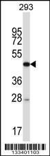 Anti-FOXN4 Rabbit Polyclonal Antibody (Biotin)