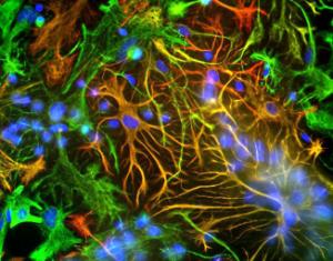 Mixed neuron-glial cultures stained with Anti-GFAP Antibody (red) and Anti-Vimentin Antibody (A85421 / green). The fibroblastic cells contain only vimentin and so are green, while astrocytes contain either vimentin and GFAP, so appear golden, or predominantly GFAP, in which case they appear red.