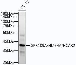 Western blot analysis of extracts of PC-12 cells, using Anti-Puma gamma / GPR109A Antibody [ARC54160] (A305514) at 1:2,000 dilution. The secondary antibody was Goat Anti-Rabbit IgG H&L Antibody (HRP) at 1:10,000 dilution.